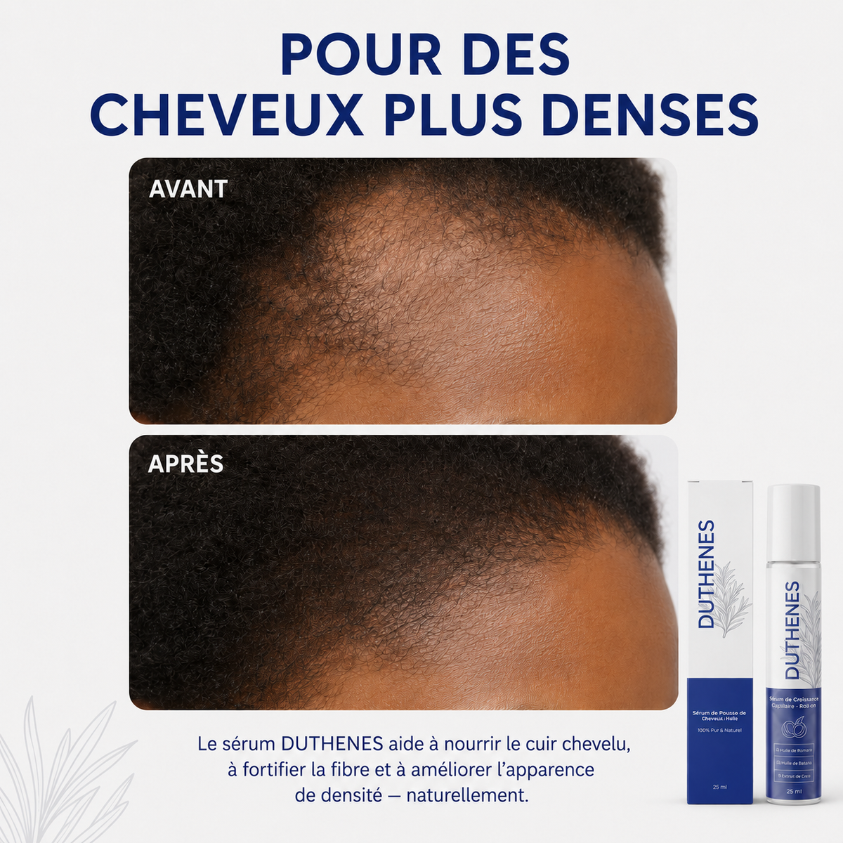 DUTHENES Sérum capillaire 🇬🇳